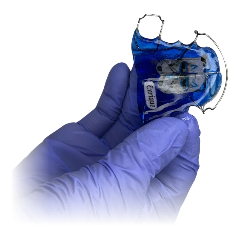 Placa de expansi&oacute;n de ortodoncia en azul