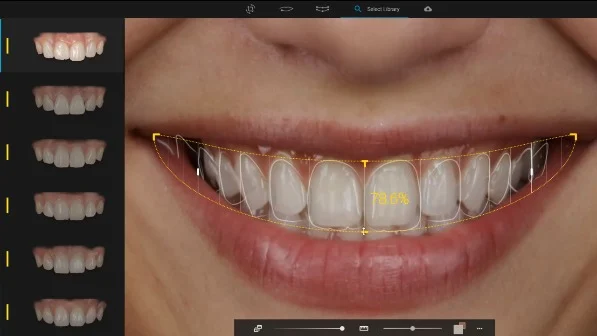 Dise&ntilde;o digital de sonrisa
