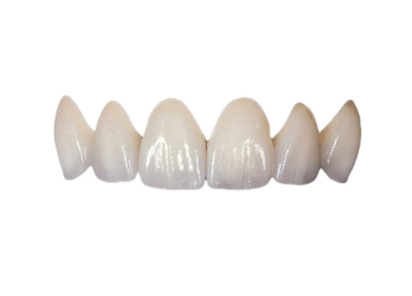 Coronas de zirconio