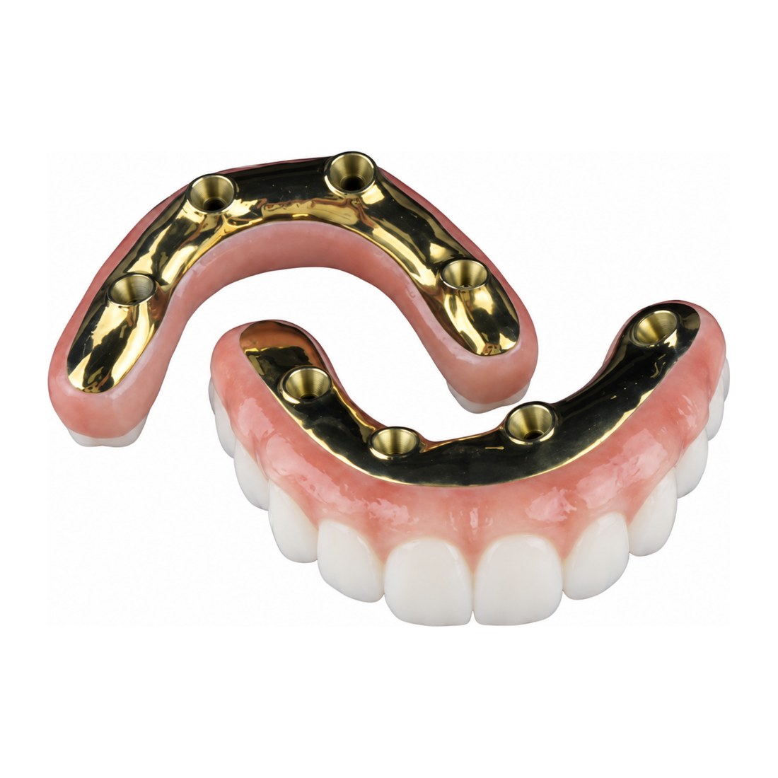 Sobredentadura sobre barra de implantes