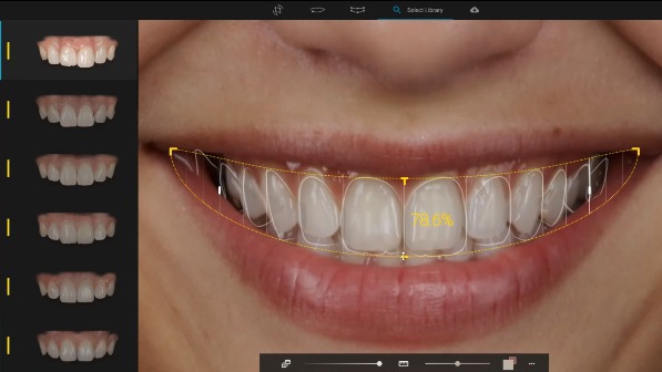Dise&ntilde;o digital de sonrisa